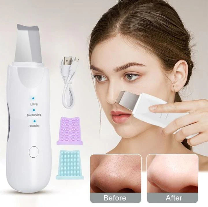 RenovaSkin® – Recupera la luminosidad natural de tu piel desde casa