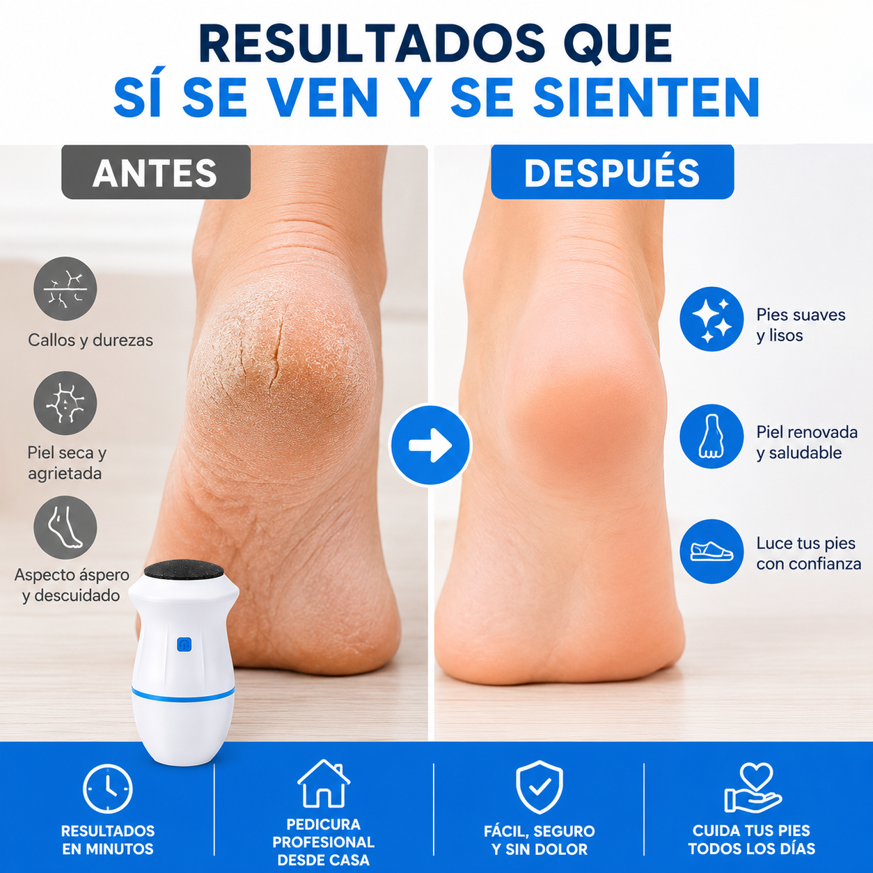 PediSoft Pro® – Pies suaves y cuidados sin salir de casa